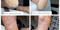 Nutzerfoto 1 Schneidermann med. Fußpflege Massage